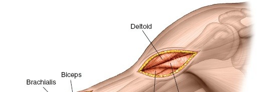 Illustration 23 for Mastering the Approach to the Distal Humerus: Safety & Skills