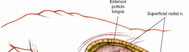 Illustration 192 for Essential Surgical Approaches: Uncover Every Aspect of the Wrist