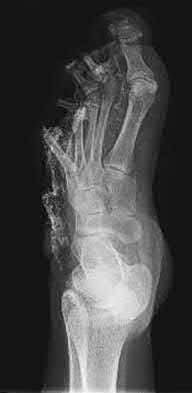 Illustration 158 for OrthoCash: Trauma MCQs & Cases for a yearold woman