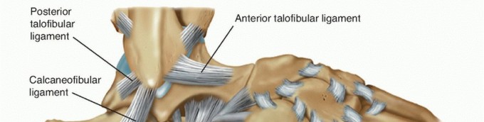 Illustration of instability chronic lateral - Dr. Mohammed Hutaif