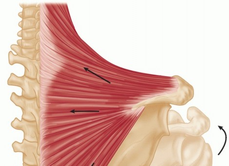 End CN XI Palsy Pain: The Eden-Lange Procedure Solution
