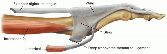 Extensor Tendon Transfer: Fix Your Flexible Hammer Toe
