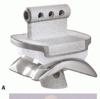 Achieve Salto Success: Mastering the Tibial Alignment Guide