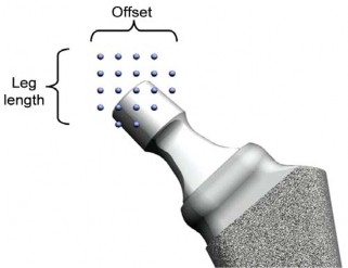 Illustration 23 for Kinectiv® Stem: Modular Necks for Primary THA Success