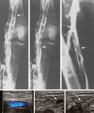 Illustration 8 for Perioperative & Orthopaedic Medicine: Preventing Dangerous Blood Clots