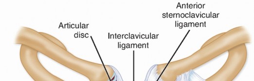Optimizing Reconstruction of Sternoclavicular Dislocation