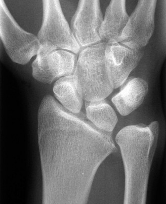 Illustration 4 for Unlock Wrist Diagnosis: Cases Guided by Figure Sunil Thirkannad