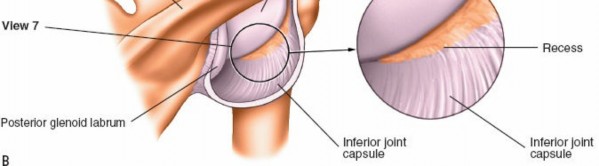 Illustration 242 for Essential Guide: Mastering Every Approach to the Shoulder