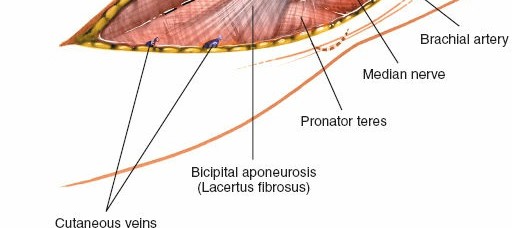 Illustration 79 for Mastering Elbow Approaches: Applied Surgical Anatomy for Precision