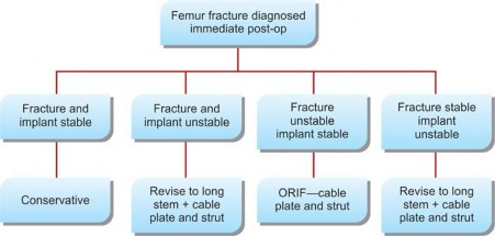 Illustration 13 for Mastering Fractures After Total Hip Arthroplasty