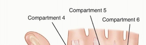 Illustration 6 for Effective K-Wire Fixation: Distal Radius Fractures Without External Fixation