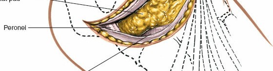 Illustration 108 for Optimized Approaches to the Dorsum of the Foot & Ankle