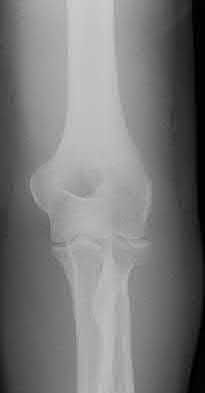 Illustration 168 for OrthoCash: Trauma MCQs & Cases for a yearold woman