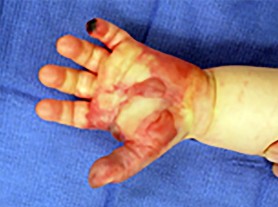 صورة طبية: دليل الأستاذ الدكتور محمد هطيف الشامل لأمراض وإصابات اليد والمعصم في صنعاء