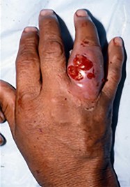 صورة توضيحية لـ دليل الأستاذ الدكتور محمد هطيف الشامل لأمراض وإصابات اليد والمعصم في صنعاء