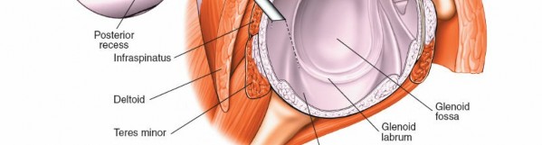 Illustration 231 for Essential Guide: Mastering Every Approach to the Shoulder