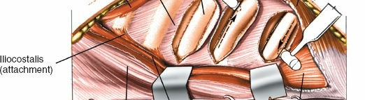 Illustration 404 for Approach to the Lumbar Spine: Mastering Techniques & Anatomy