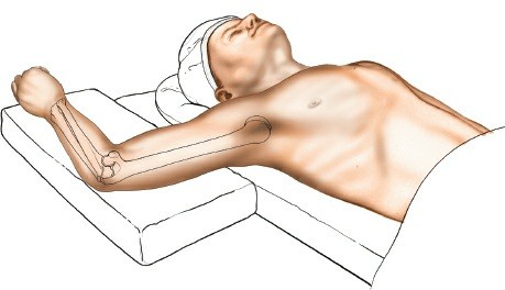 Illustration 15 for Mastering Elbow Approaches: Applied Surgical Anatomy for Precision