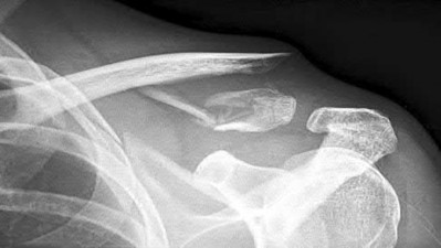 Illustration 86 for OrthoCash: Trauma MCQs & Cases for a yearold woman