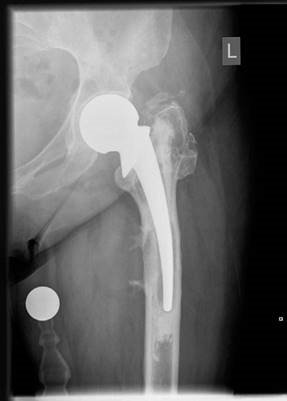 Structured Hip Oral: Master This Exam Question & Case