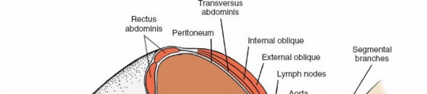 Illustration 34 for Master the Anterolateral Retroperitoneal Approach to Lumbar Spine