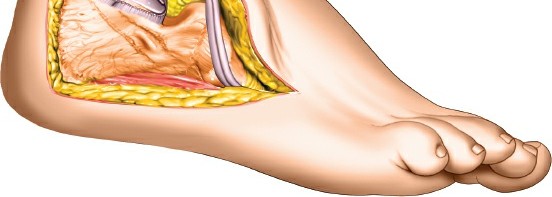 Illustration 134 for Optimized Approaches to the Dorsum of the Foot & Ankle