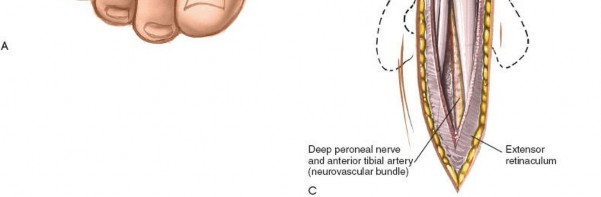 Illustration 7 for Optimized Approaches to the Dorsum of the Foot & Ankle