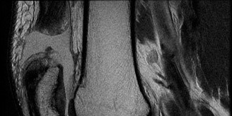 Illustration 4 for Solve Sports Medicine Cases: Uncover Why the Correct Answer Is E