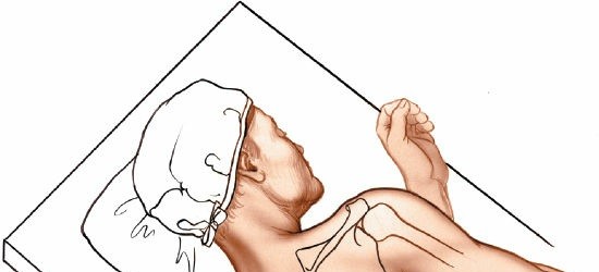 Posterior Shoulder Joint Approach: Anatomy, Indications, & Surgical Techniques