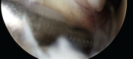 Illustration of principles of ankle - Dr. Mohammed Hutaif