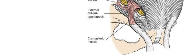 Illustration 22 for Navigating the Anatomy of the Ilioinguinal in Acetabular Surgery