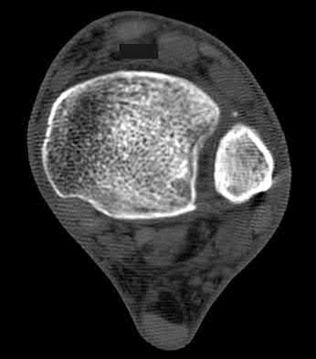 Illustration 64 for OrthoCash: Trauma MCQs & Cases for a yearold woman