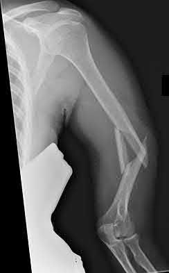 Illustration 178 for OrthoCash: Trauma MCQs & Cases for a yearold woman