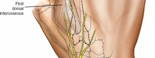 Illustration 10 for Key Approaches for External Fixation: Humerus, Radius, Ulna, Wrist