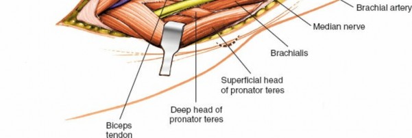 Illustration 83 for Mastering Elbow Approaches: Applied Surgical Anatomy for Precision