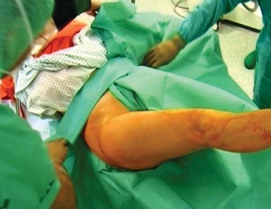 Illustration of approach in minimally - Dr. Mohammed Hutaif