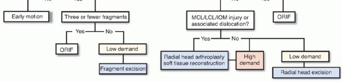 Illustration 22 for Radial Head & Neck Fractures: Mastering ORIF for Best Results