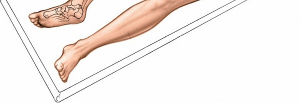 Illustration 15 for Step-by-Step Medial Side of the Ankle Approach Guide