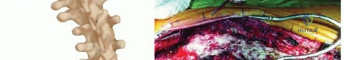 التهاب المفاصل الالتهابي والتنكسي الدليل الطبي الشامل
