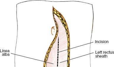 Illustration 82 for Approach to the Lumbar Spine: Mastering Techniques & Anatomy