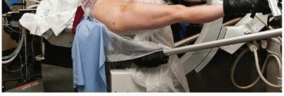 Illustration 11 for Beyond Knee Surg: Hip Arthroscopy for Sports Injuries