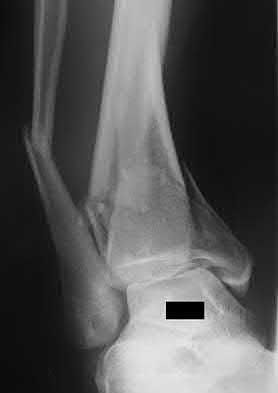 Illustration 95 for OrthoCash: Trauma MCQs & Cases for a yearold woman