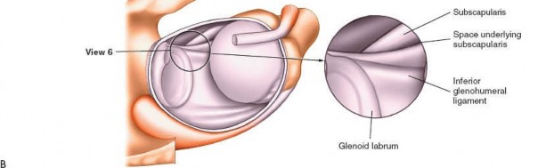 Illustration 238 for Essential Guide: Mastering Every Approach to the Shoulder