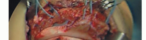 Illustration 7 for Repair & Recover from Collateral Ligament Injuries: Your Guide