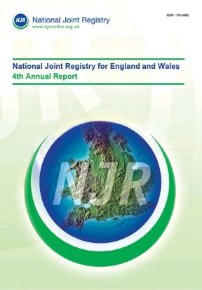 Illustration 16 for Looking for the Ideal Hip Implant? Uncover Key Factors
