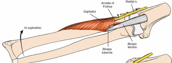 Illustration 68 for Mastering Elbow Approaches: Applied Surgical Anatomy for Precision