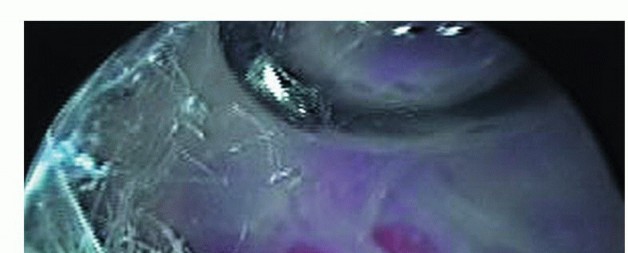 Illustration 18 for Is Your Dorsal Scapular Nerve Causing Snapping Scapula Pain?