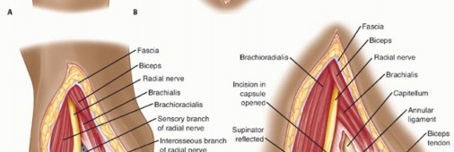 Illustration 60 for Surgical Approaches to Shoulder & Elbow: Pearls and Pitfalls