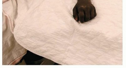 Illustration 7 for Distal Radius Fixation: Precision Through Lister's Tubercle