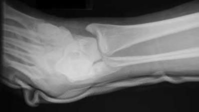 Illustration 98 for OrthoCash: Trauma MCQs & Cases for a yearold woman